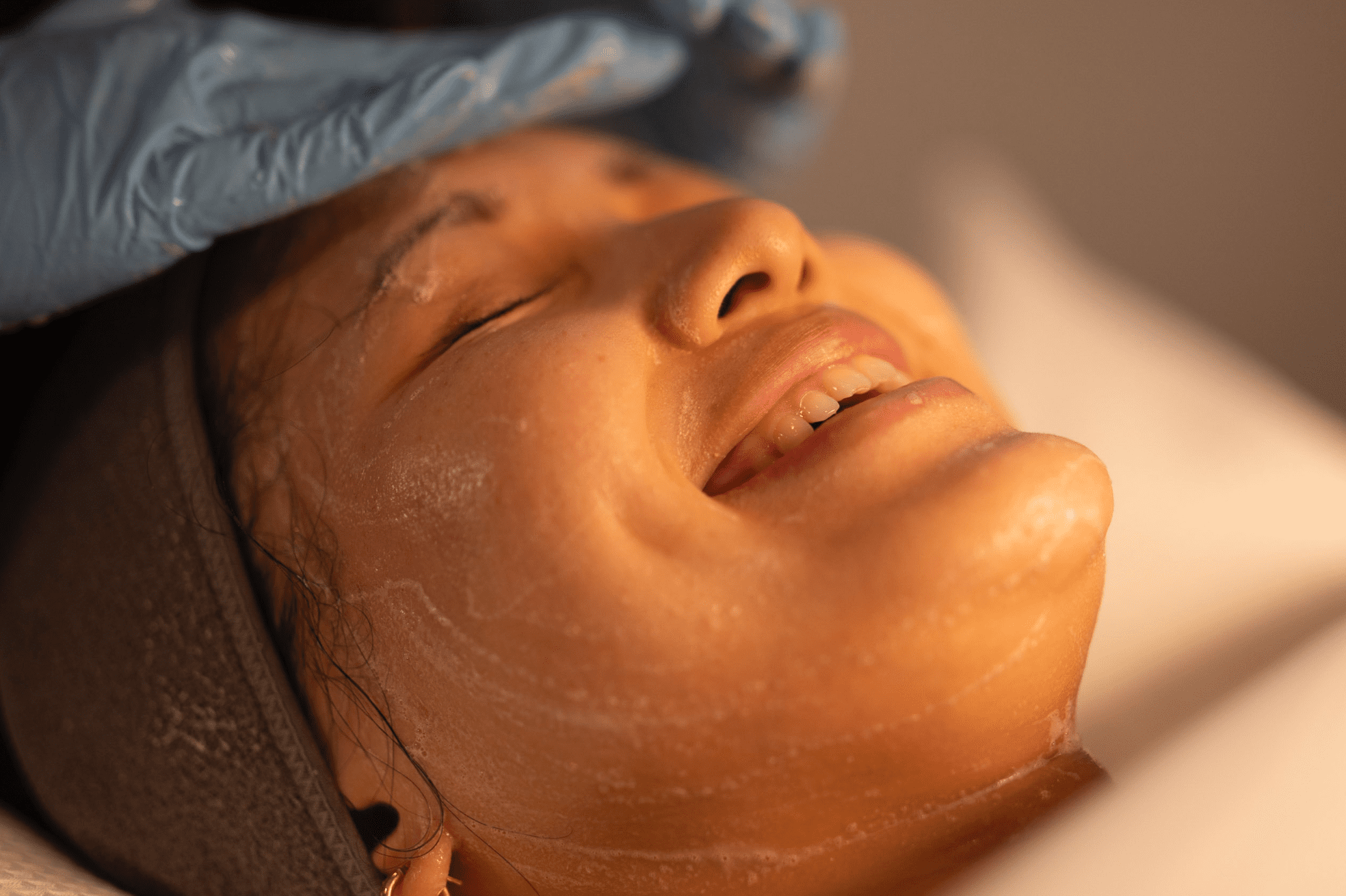 A close-up of a woman receiving a hyperpigmentation treatment, smiling with her eyes closed while a gloved hand applies Dermamelan to her forehead under warm lighting.