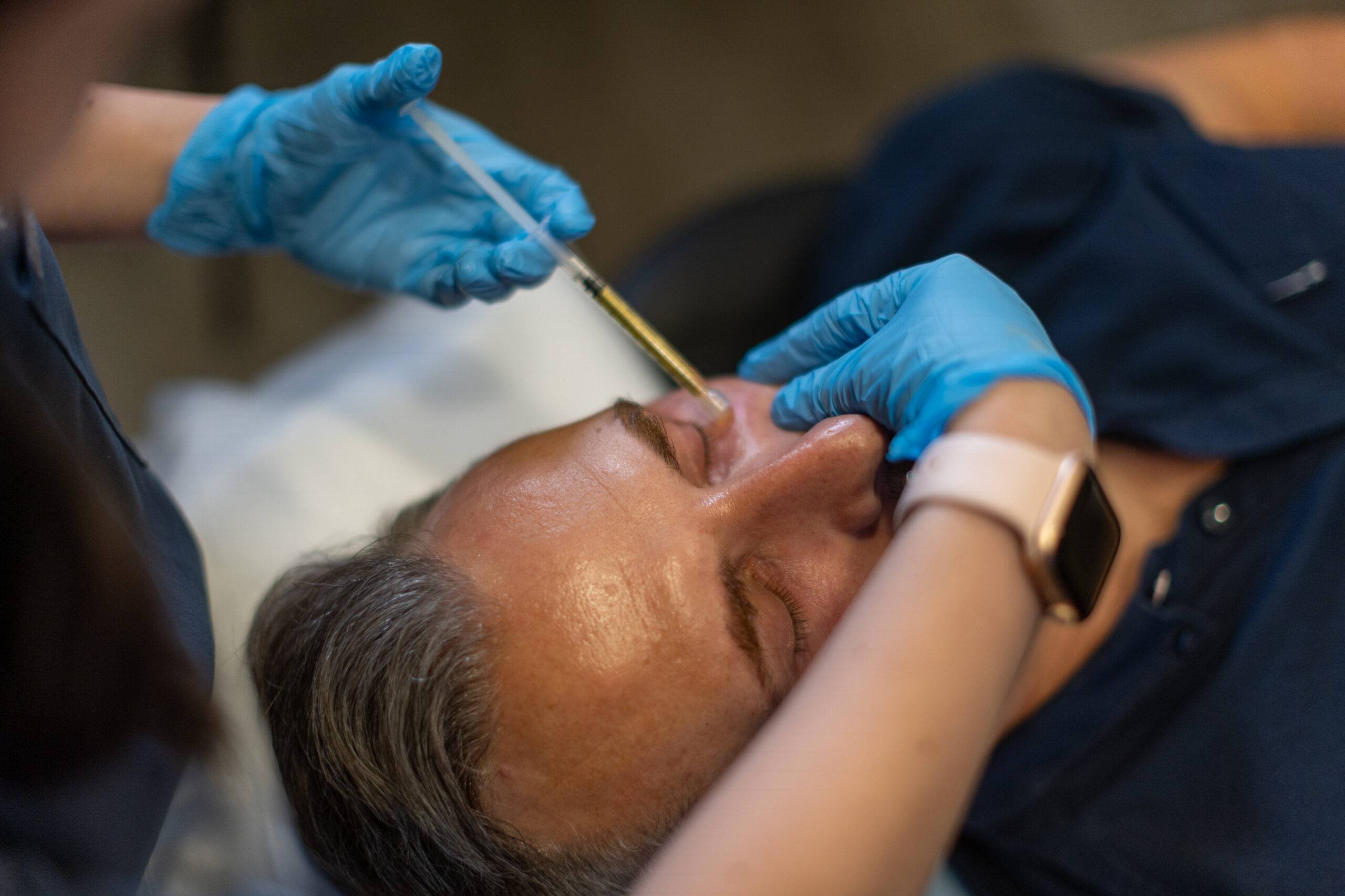 A close-up of a person receiving a skin rejuvenation treatment, with a practitioner in blue gloves applying a product with a brush-like tool to their forehead.